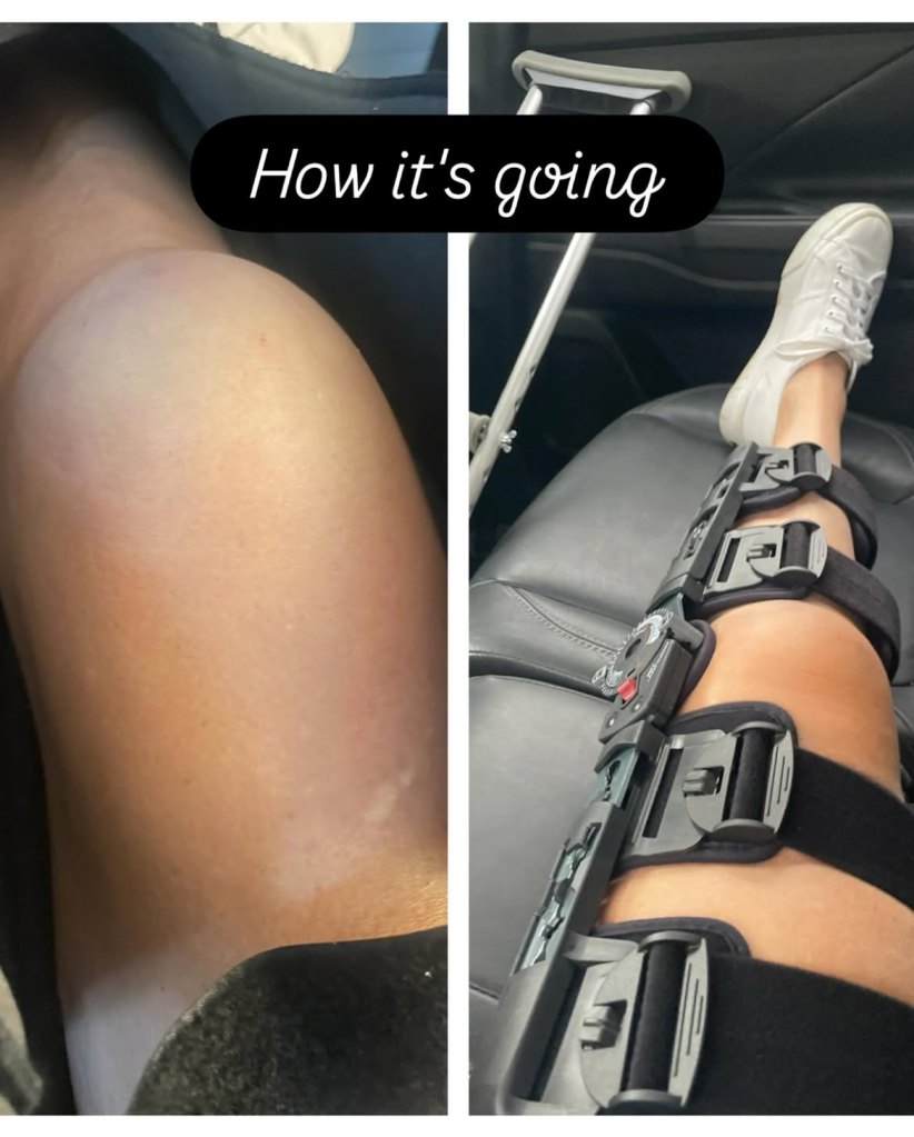Eileen Davidson knee