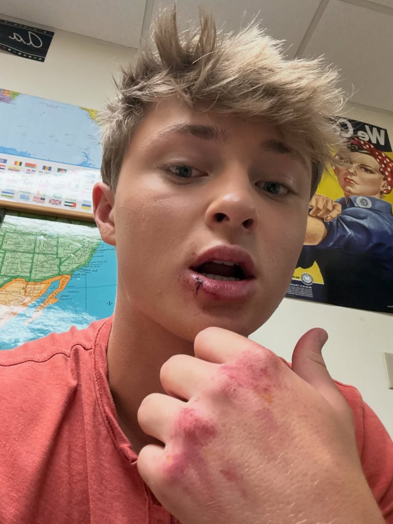 GH Asher Antozyn BTS